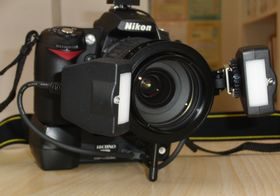 口腔内写真は何のため？その４