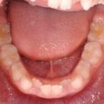 学童期からはじめる健康の基礎つくりその3