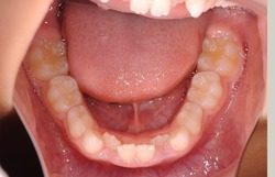 学童期からはじめる健康の基礎つくりその3