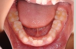 学童期からはじめる健康の基礎つくりその2